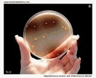 bile esculin agar